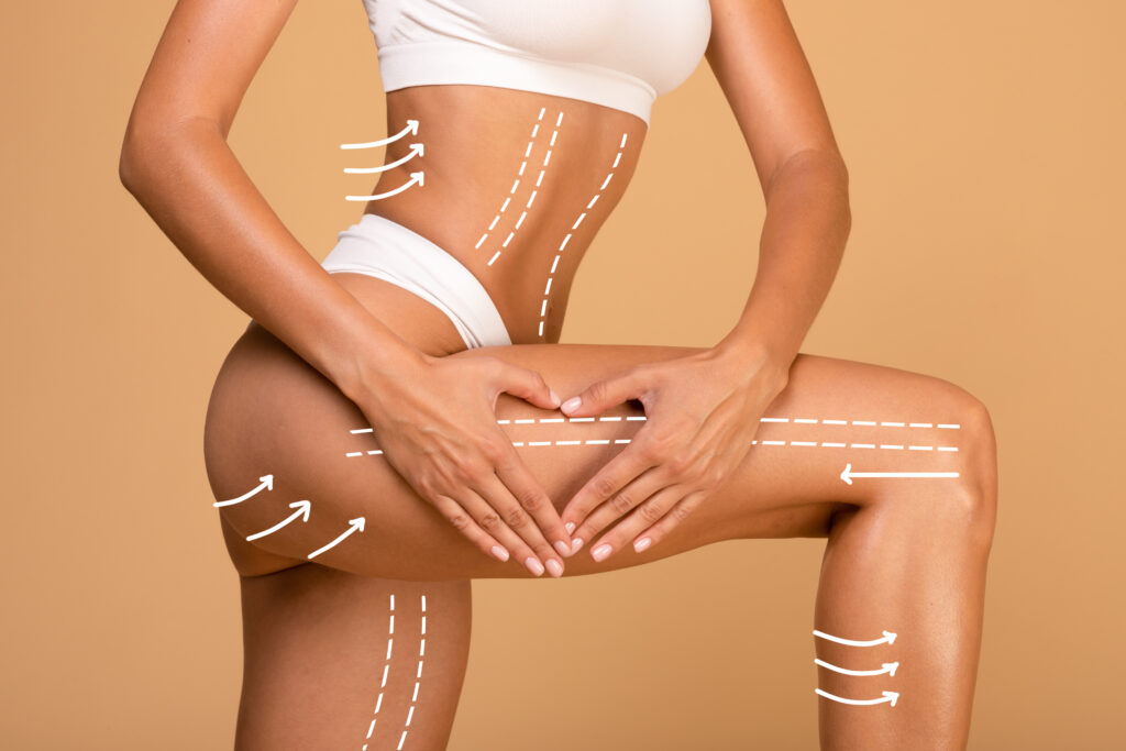 Structure of treatment lines on Women's body | Get J-Plasma in The Botox Bar and Aesthetics at Dallas & Sherman, TX