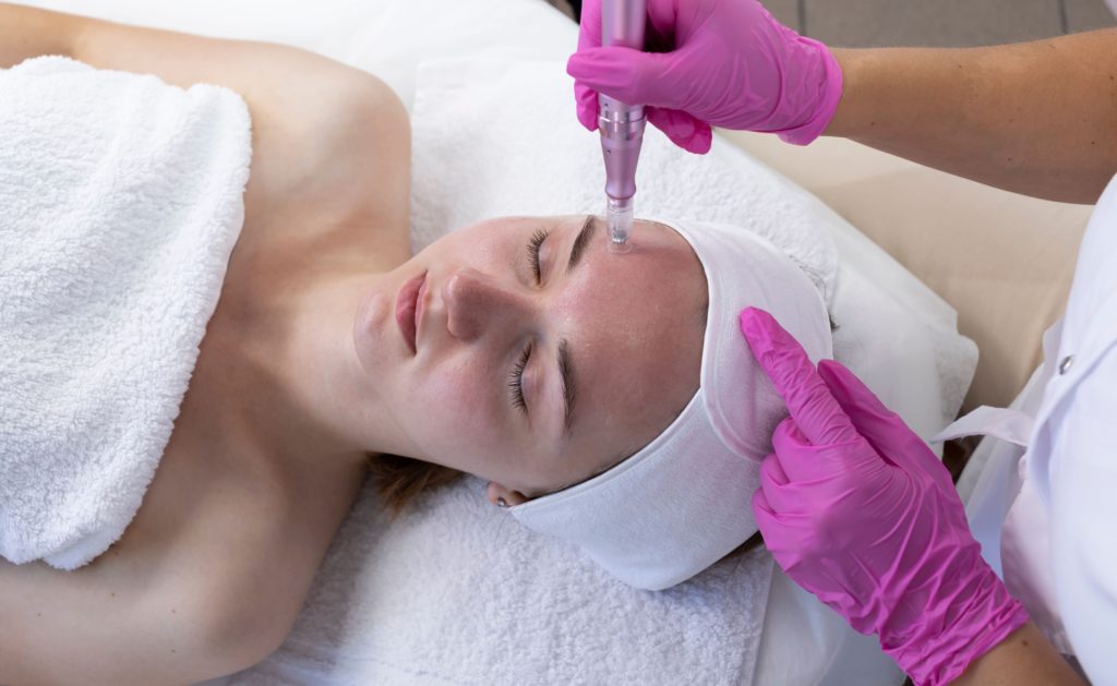 Microneedling-By-The-Botox-Bar-and-Aesthetics-in-Dallas